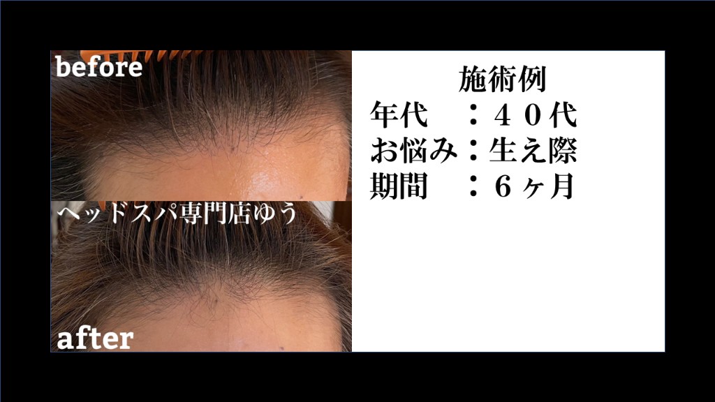 Before & After 4